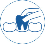 illustration of a tool pulling a tooth out depicting extracting a tooth